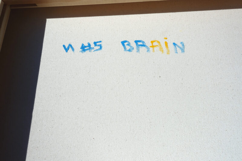 VA #5 - Brain - Photo 6